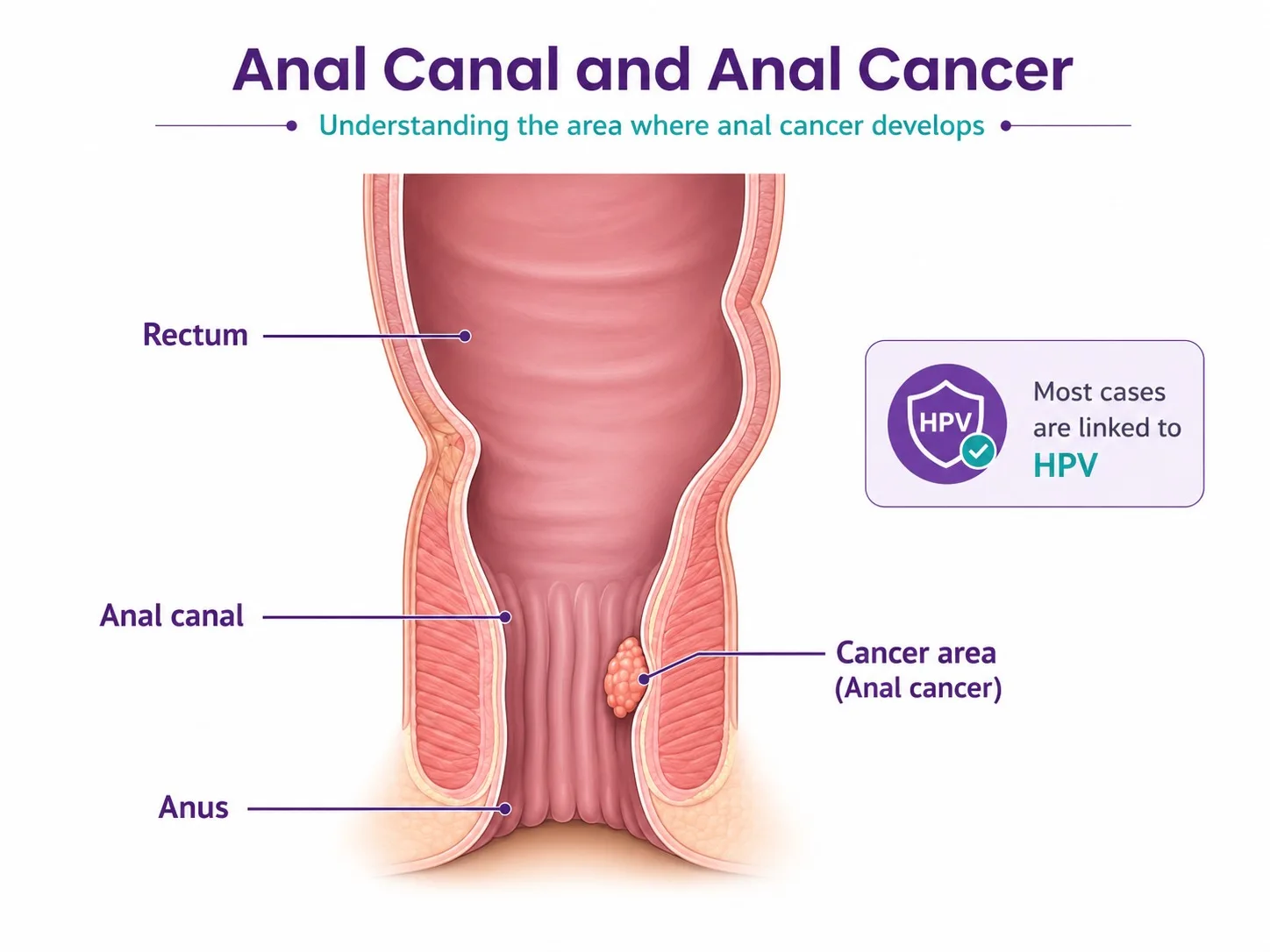 Discreet clinical anatomy of the anal canal and HPV link - CION Cancer Clinics