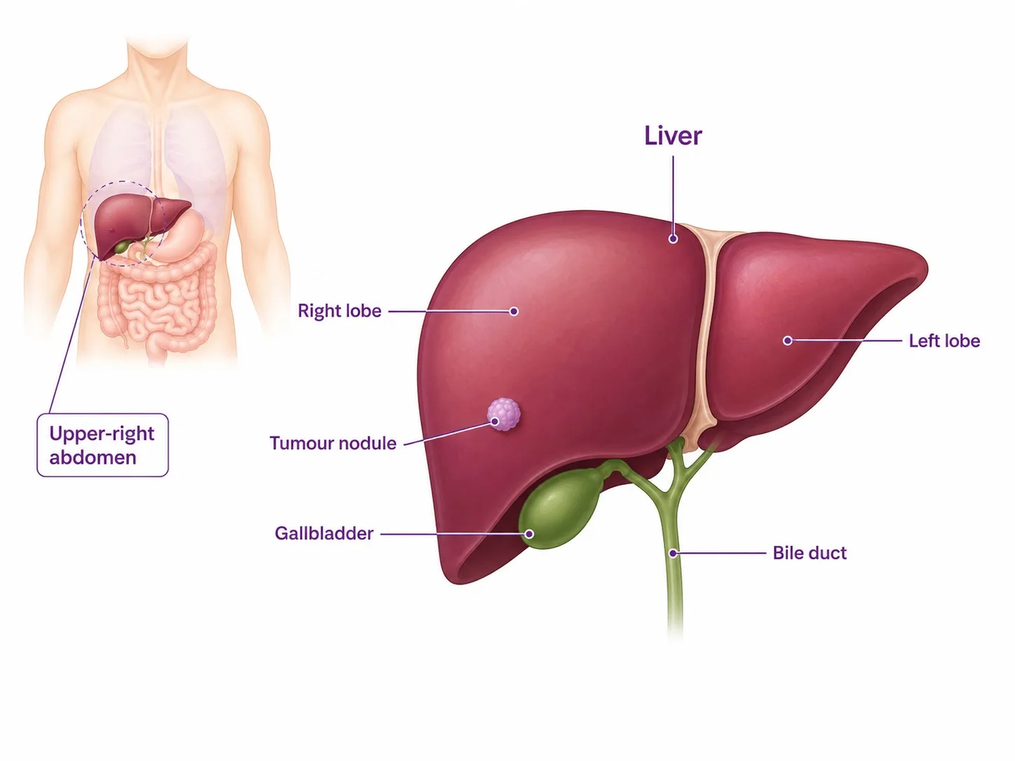 Labelled anatomy of the liver showing where liver cancer develops - CION Cancer Clinics