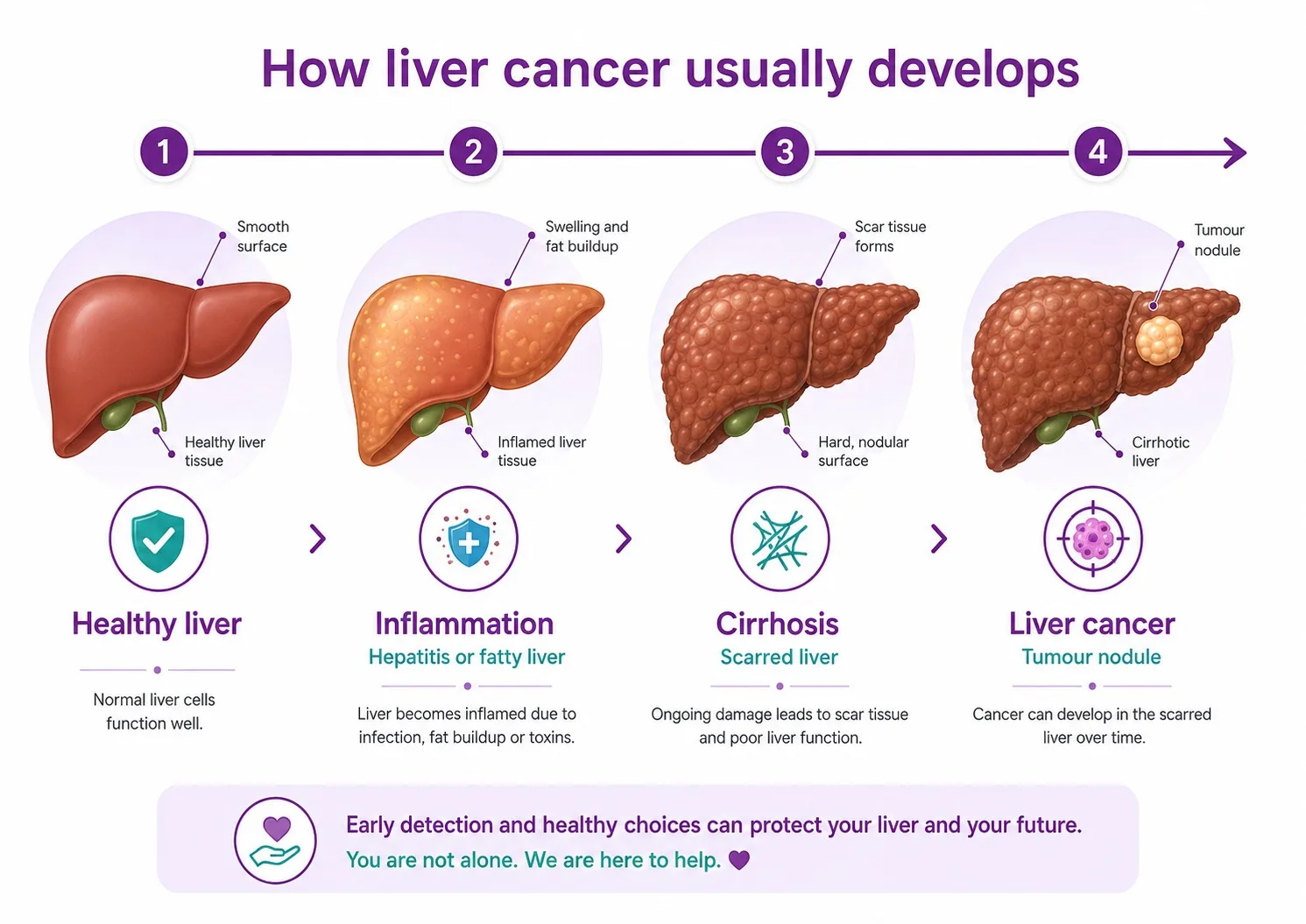 Illustration of how chronic liver disease develops into liver cancer - CION Cancer Clinics