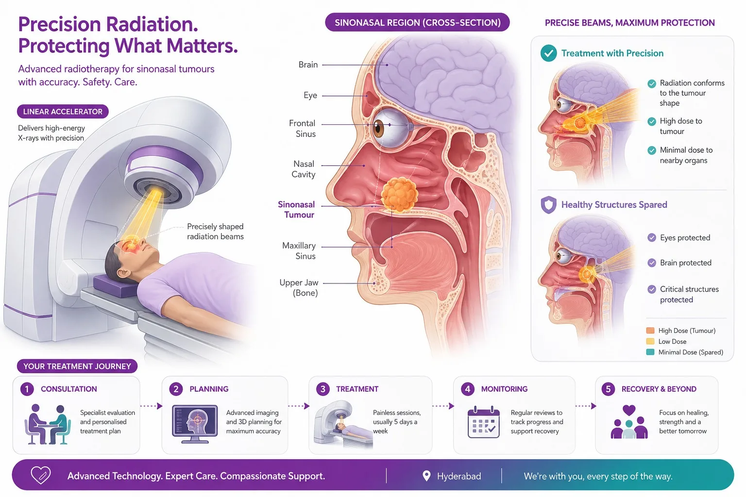 Labelled cross-section of the nasal cavity and sinuses - CION Cancer Clinics