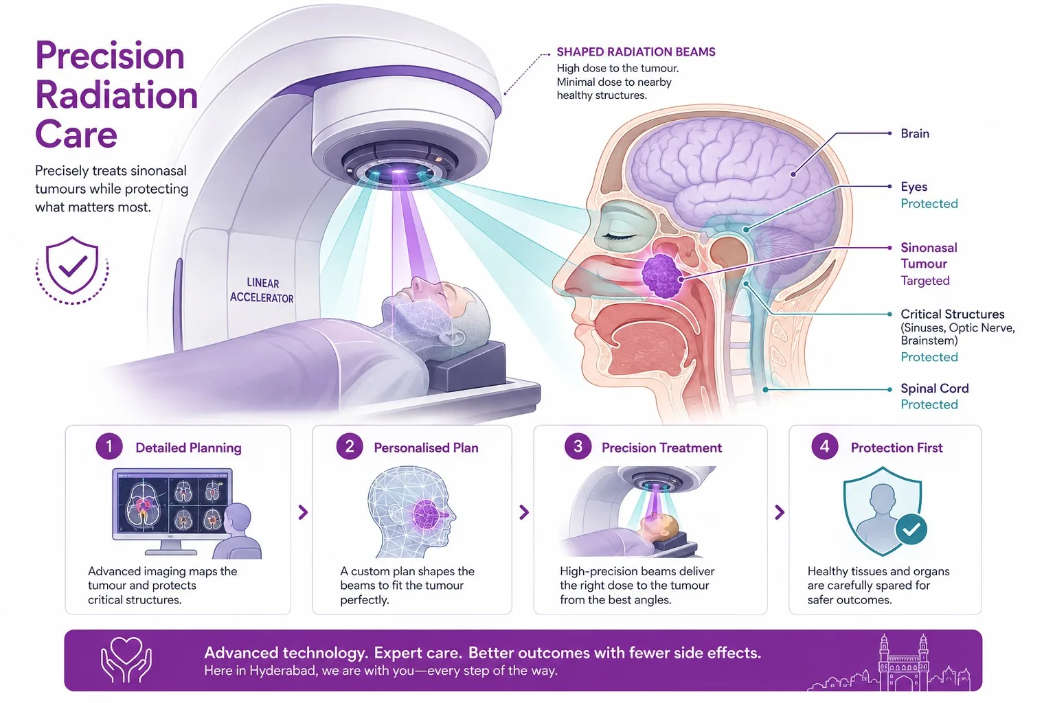 Precisely targeted radiation for nasal and sinus cancer - CION Cancer Clinics