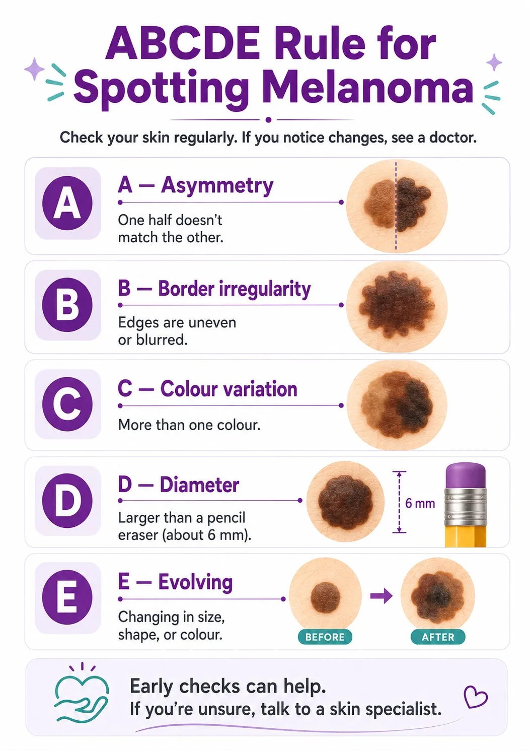 ABCDE self-check guide for spotting melanoma - CION Cancer Clinics, Hyderabad