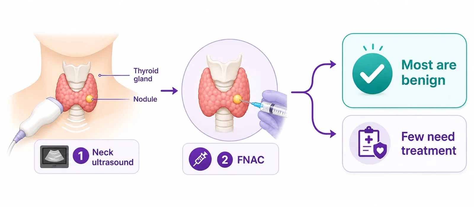 How thyroid nodules are assessed - most are benign - CION Cancer Clinics